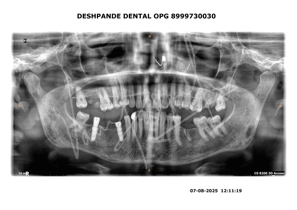 X-ray Image 1