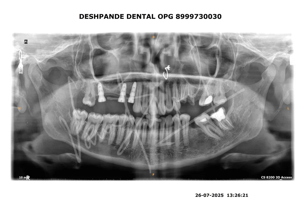 X-ray Image 2