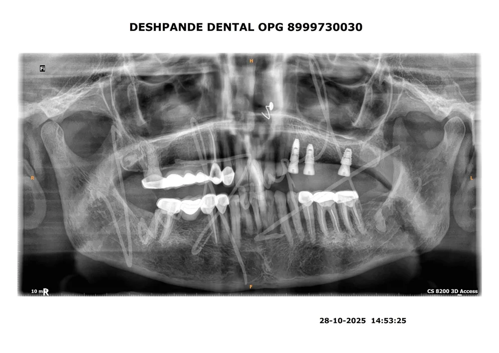 X-ray Image 4
